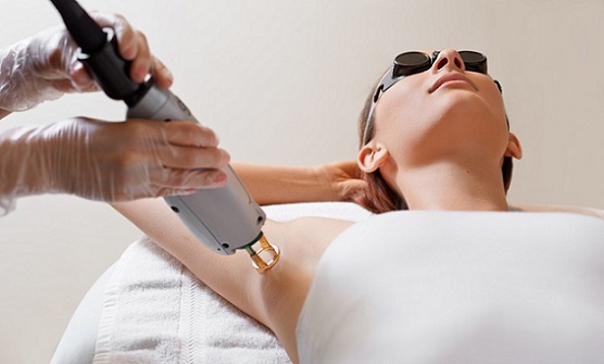 Laser Hair Removal - Eliminate Unwanted Body Hair #FrizeMedia